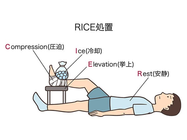 RICE処置のイラスト